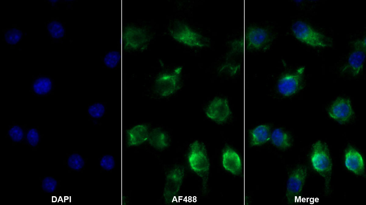 白介素1β(IL1b)单克隆抗体