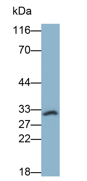 白介素1β(IL1b)单克隆抗体