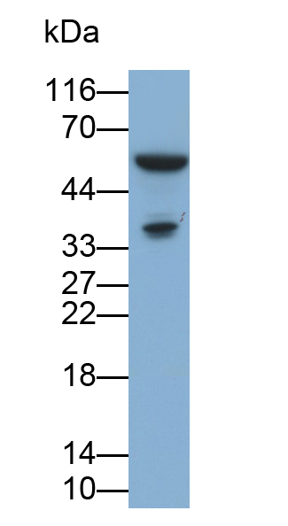 白介素1β(IL1b)单克隆抗体