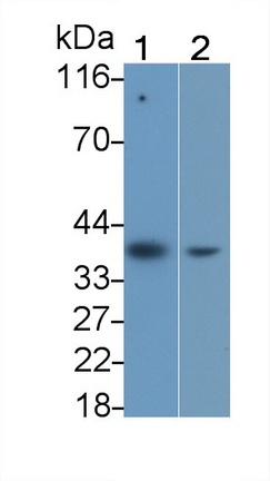白介素1β(IL1b)單克隆抗體