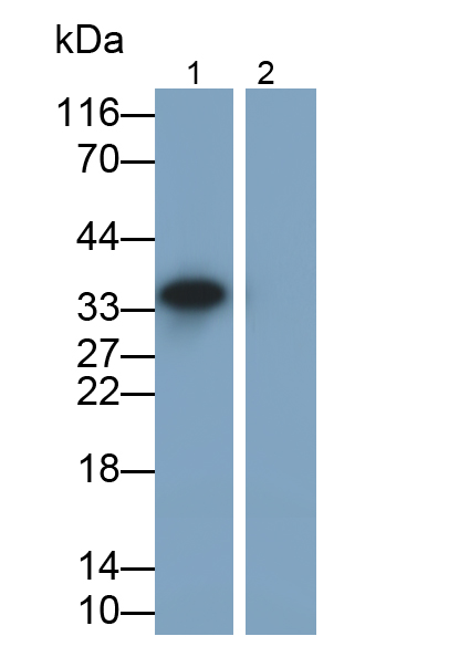 白介素1β(IL1b)單克隆抗體