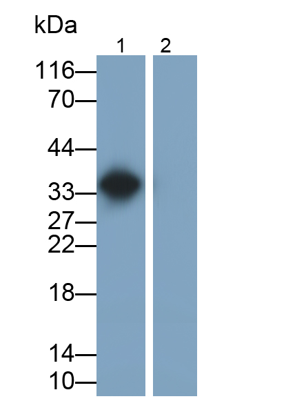 白介素1β(IL1b)單克隆抗體