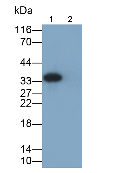 白介素1β(IL1b)單克隆抗體