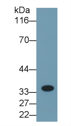 白介素1β(IL1b)單克隆抗體