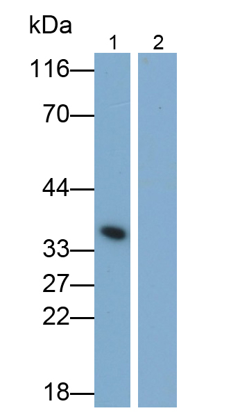白介素1β(IL1b)單克隆抗體