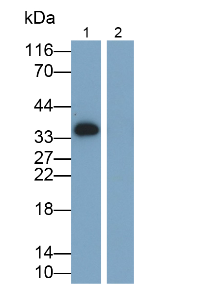 白介素1β(IL1b)單克隆抗體