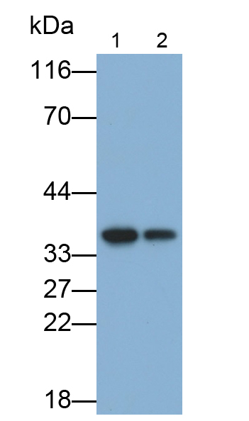 白介素1β(IL1b)单克隆抗体