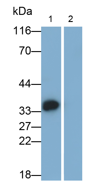 白介素1β(IL1b)单克隆抗体
