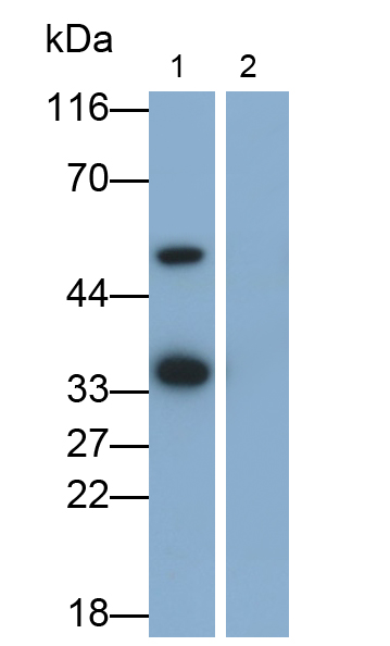 白介素1β(IL1b)單克隆抗體