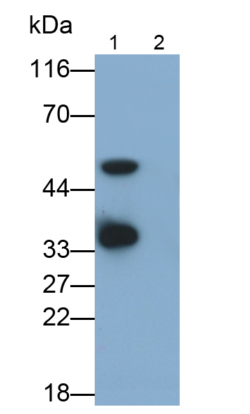 白介素1β(IL1b)單克隆抗體