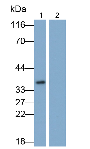 白介素1β(IL1b)单克隆抗体