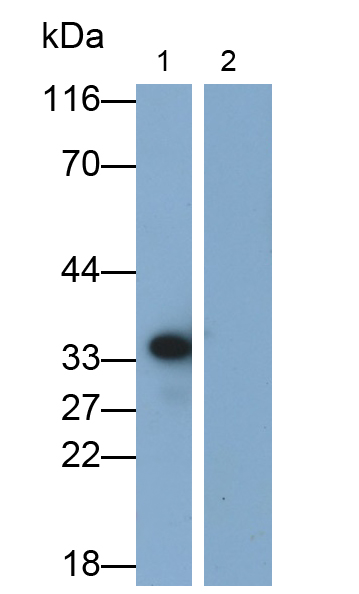 白介素1β(IL1b)單克隆抗體