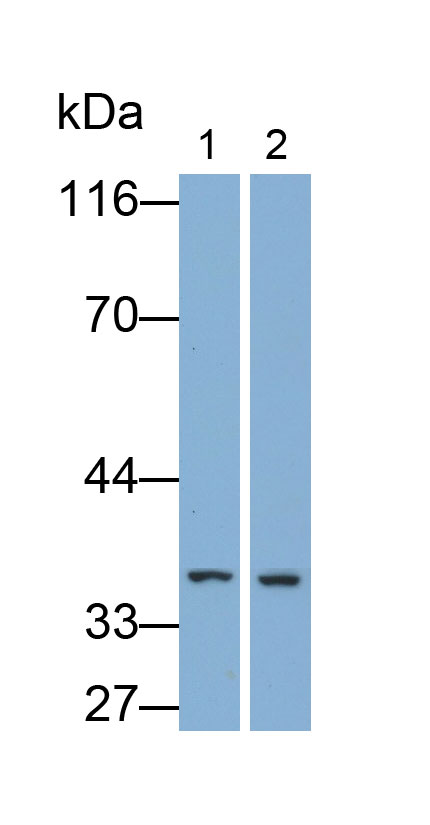 白介素1β(IL1b)单克隆抗体