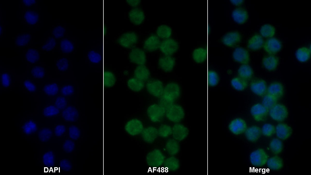 白介素1β(IL1b)單克隆抗體