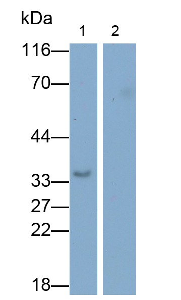 白介素1β(IL1b)單克隆抗體