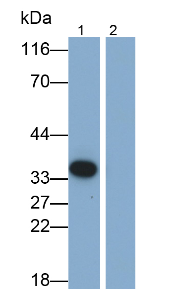 白介素1β(IL1b)單克隆抗體