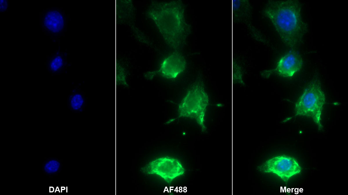 白介素1β(IL1b)单克隆抗体