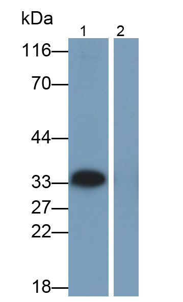 白介素1β(IL1b)单克隆抗体