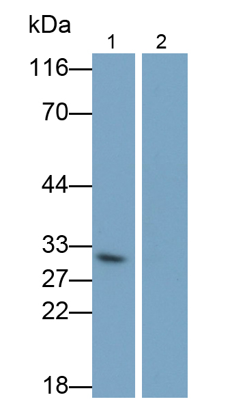 白介素1β(IL1b)單克隆抗體