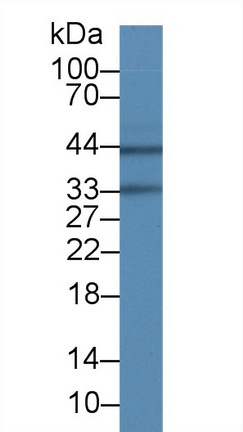 水通道蛋白4(AQP4)单克隆抗体