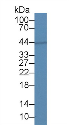 水通道蛋白4(AQP4)单克隆抗体