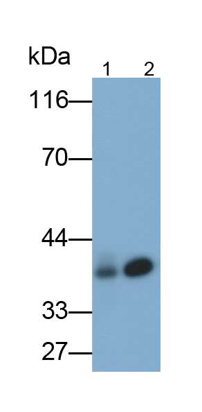 水通道蛋白4(AQP4)单克隆抗体
