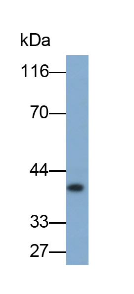 水通道蛋白4(AQP4)单克隆抗体