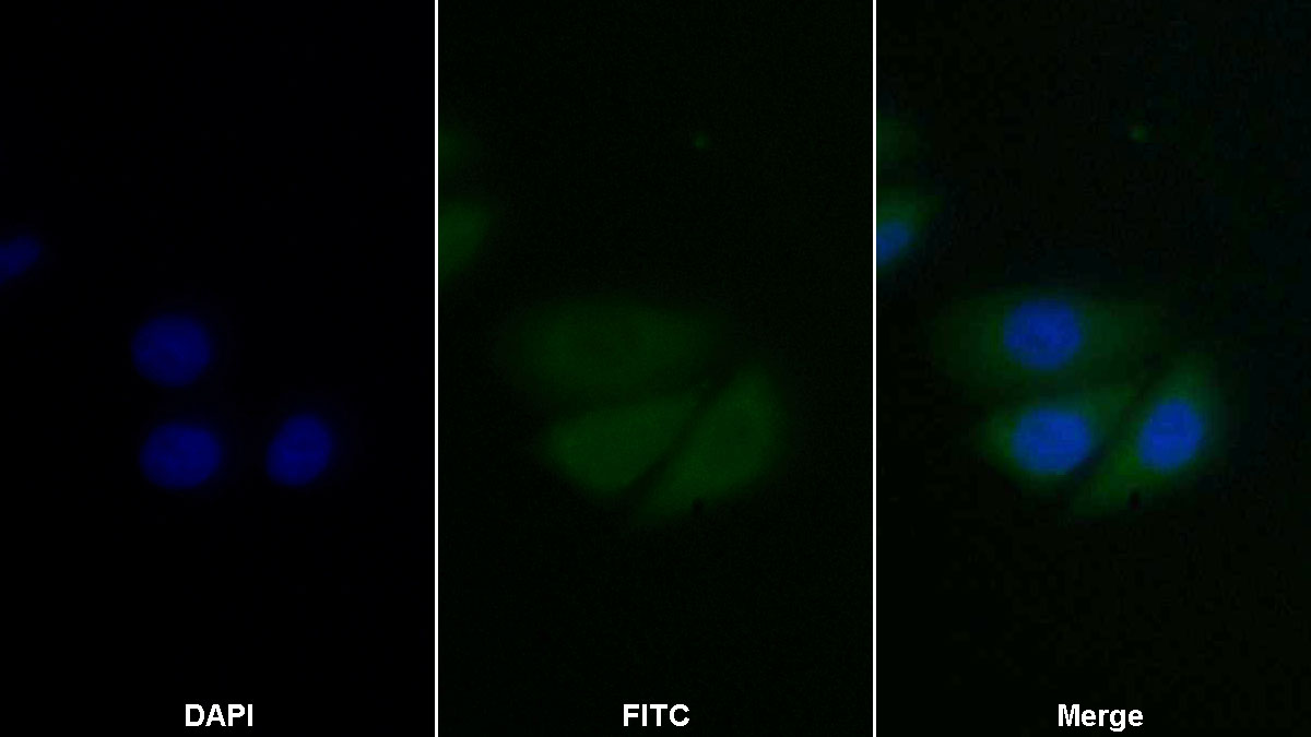 抗增殖细胞核抗原(PCNA)单克隆抗体