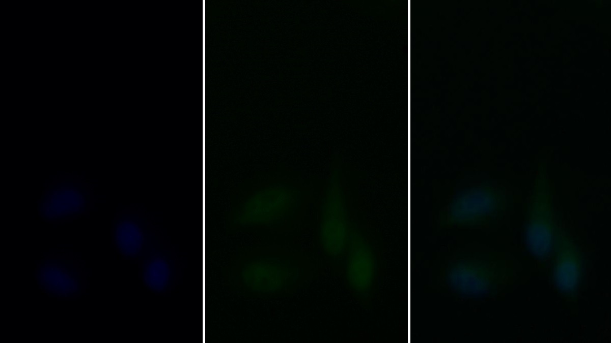 抗增殖细胞核抗原(PCNA)单克隆抗体