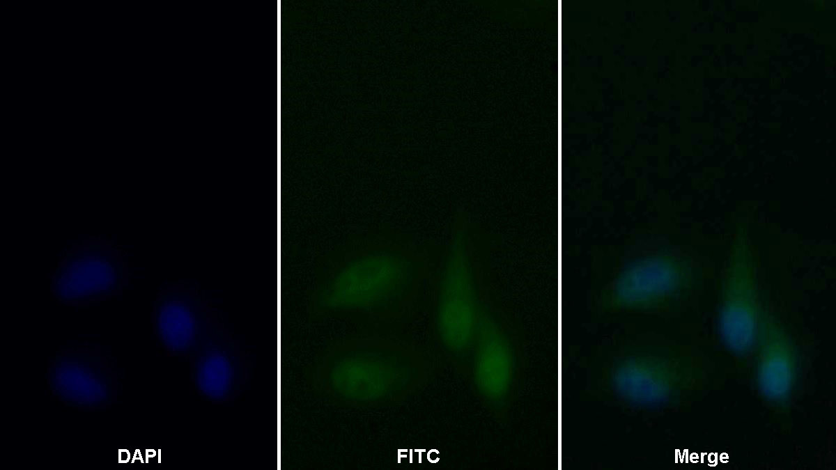 抗增殖细胞核抗原(PCNA)单克隆抗体