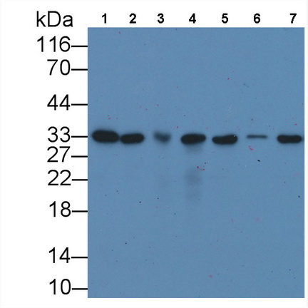 抗增殖細(xì)胞核抗原(PCNA)單克隆抗體