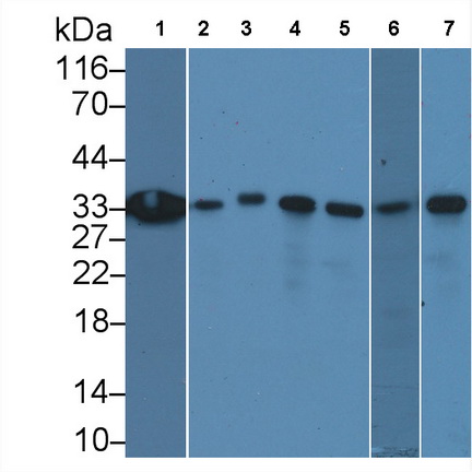 抗增殖細(xì)胞核抗原(PCNA)單克隆抗體