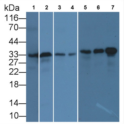 抗增殖細(xì)胞核抗原(PCNA)單克隆抗體