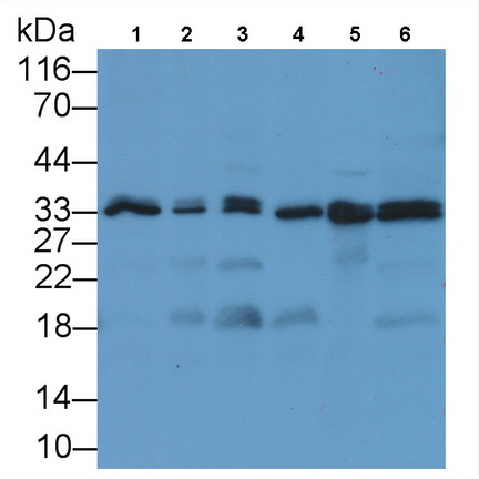 抗增殖細(xì)胞核抗原(PCNA)單克隆抗體