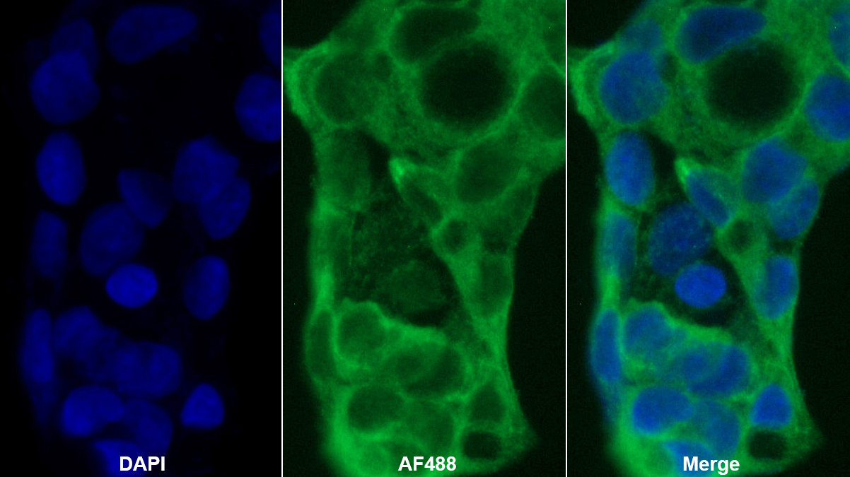 載脂蛋白B100(APOB100)單克隆抗體