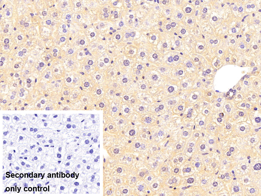 谷胱甘肽S轉(zhuǎn)移酶θ1(GSTt1)單克隆抗體