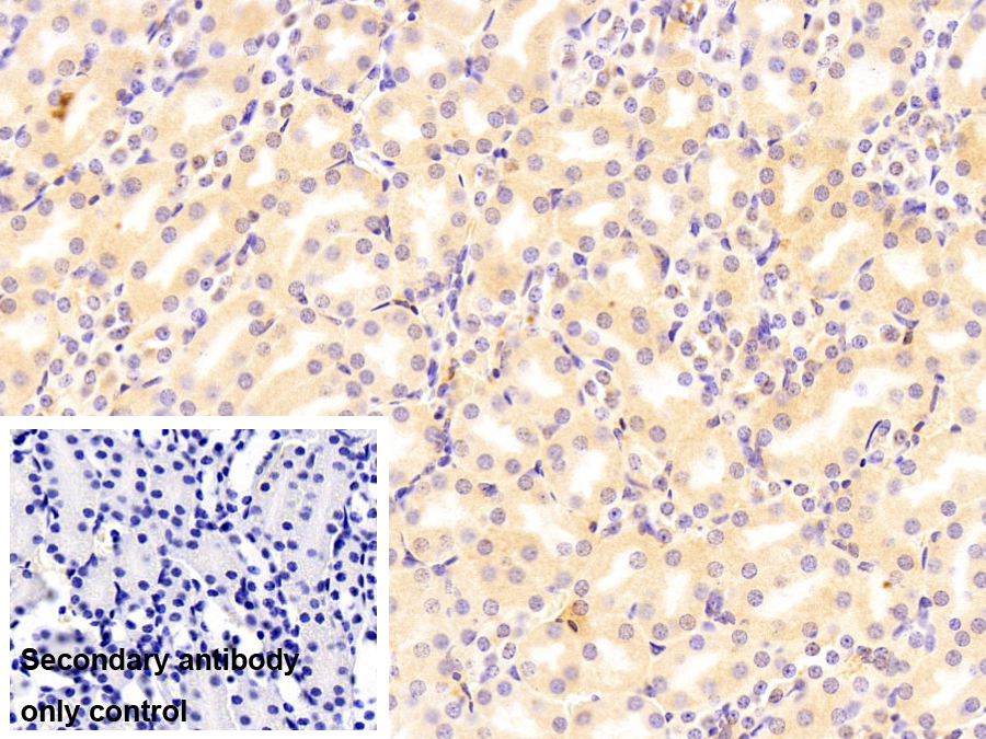 谷胱甘肽S轉(zhuǎn)移酶θ1(GSTt1)單克隆抗體