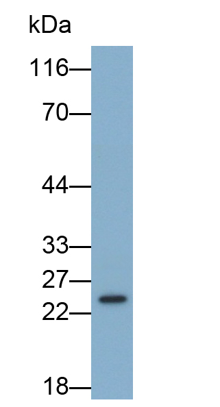 谷胱甘肽S转移酶θ1(GSTt1)单克隆抗体