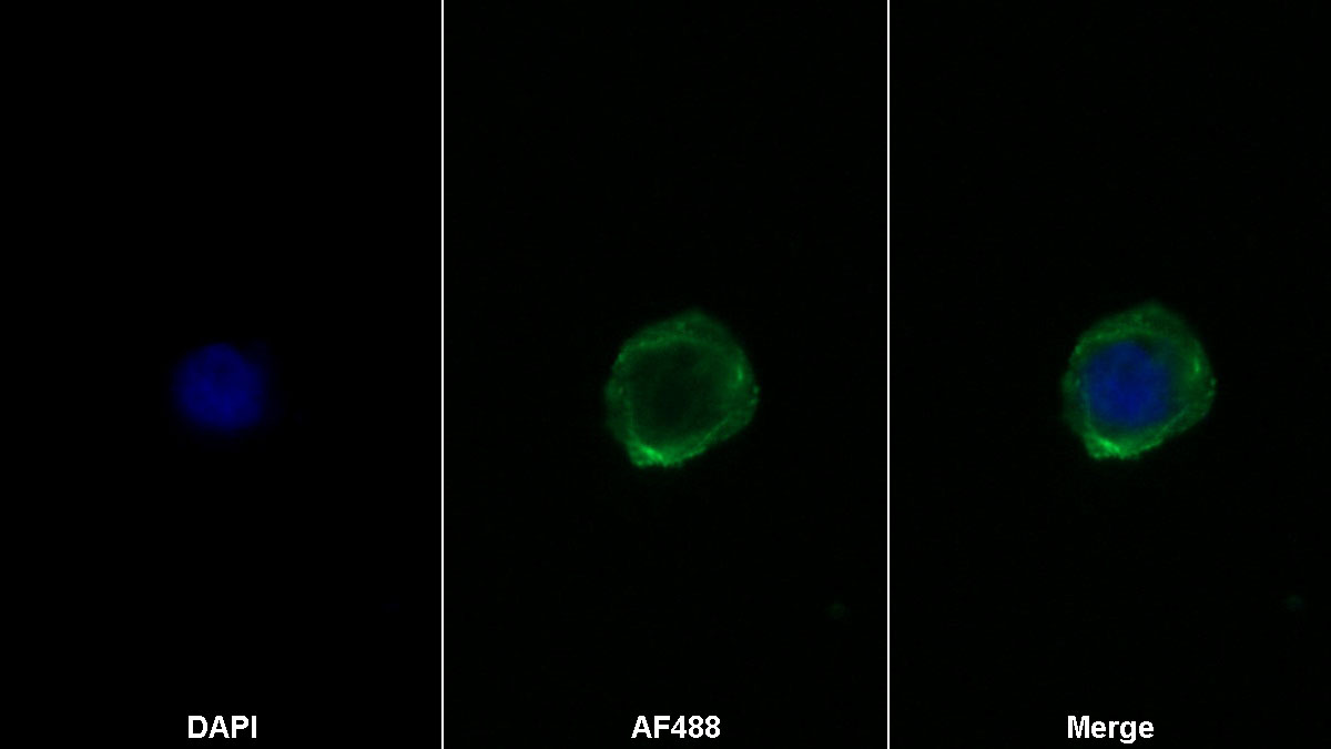 CD28分子(CD28)單克隆抗體