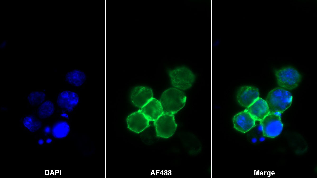 CD28分子(CD28)單克隆抗體