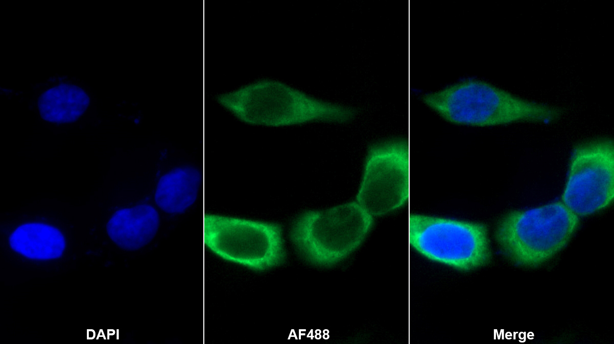 白介素7(IL7)單克隆抗體