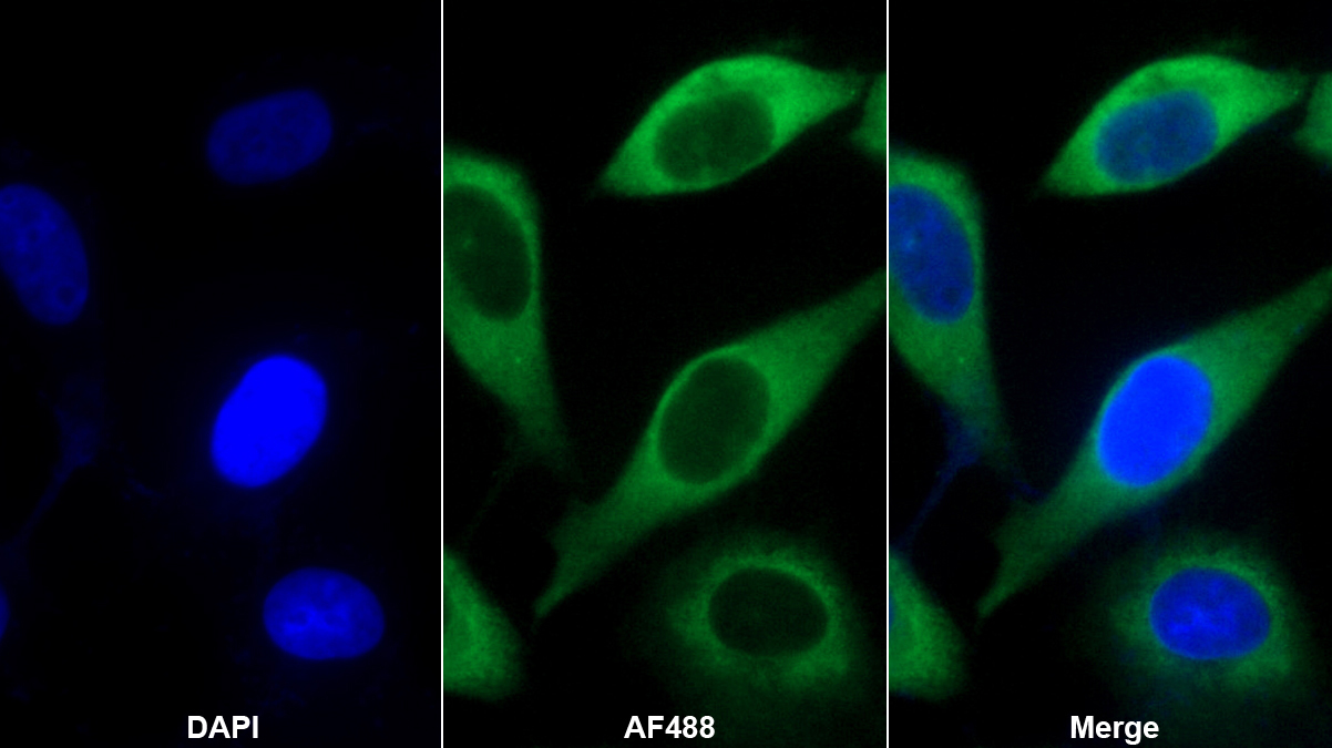 白介素7(IL7)單克隆抗體