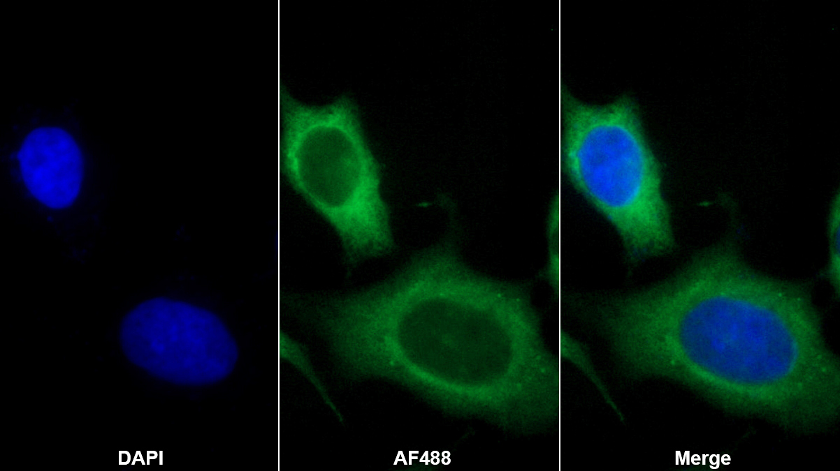 白介素7(IL7)單克隆抗體