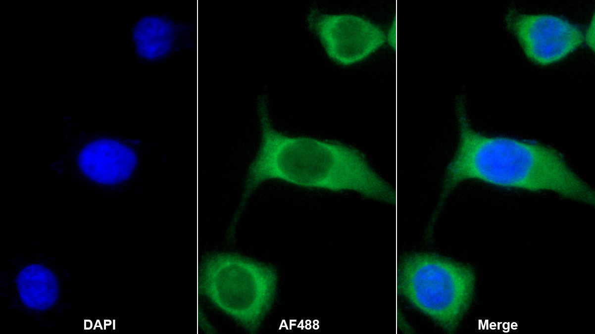 白介素7(IL7)單克隆抗體