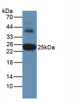 谷胱甘肽S转移酶α3(GSTa3)单克隆抗体