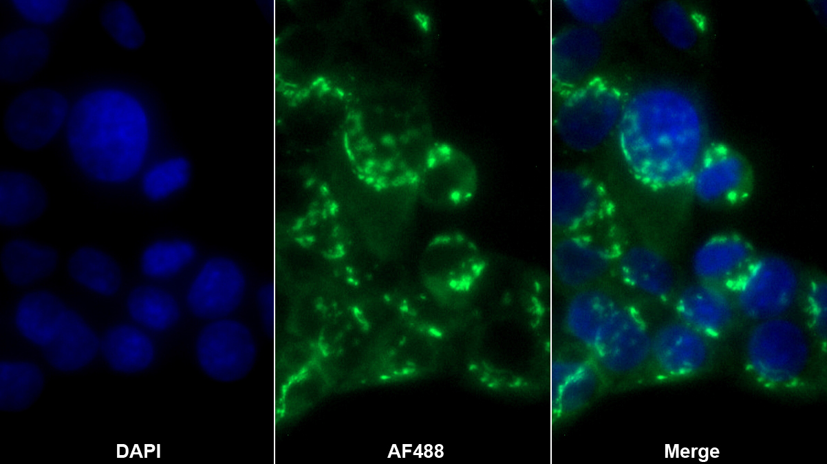 粘蛋白5B(MUC5B)單克隆抗體