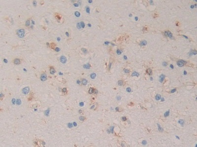 27kDa熱休克蛋白(Hsp27)單克隆抗體