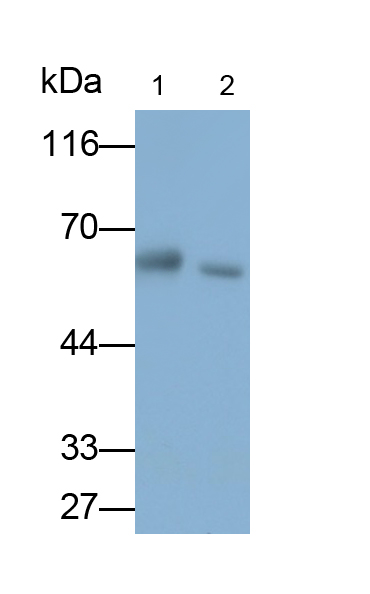 棕櫚酰化膜蛋白6(MPP6)單克隆抗體