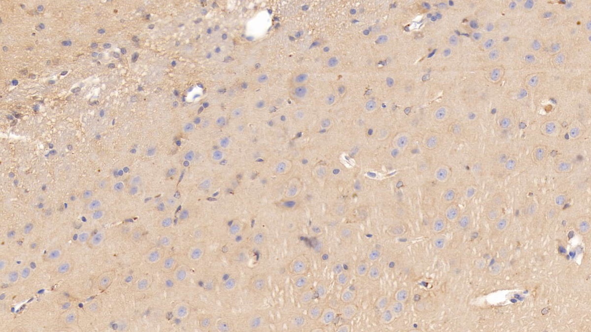 載脂蛋白E(APOE)單克隆抗體