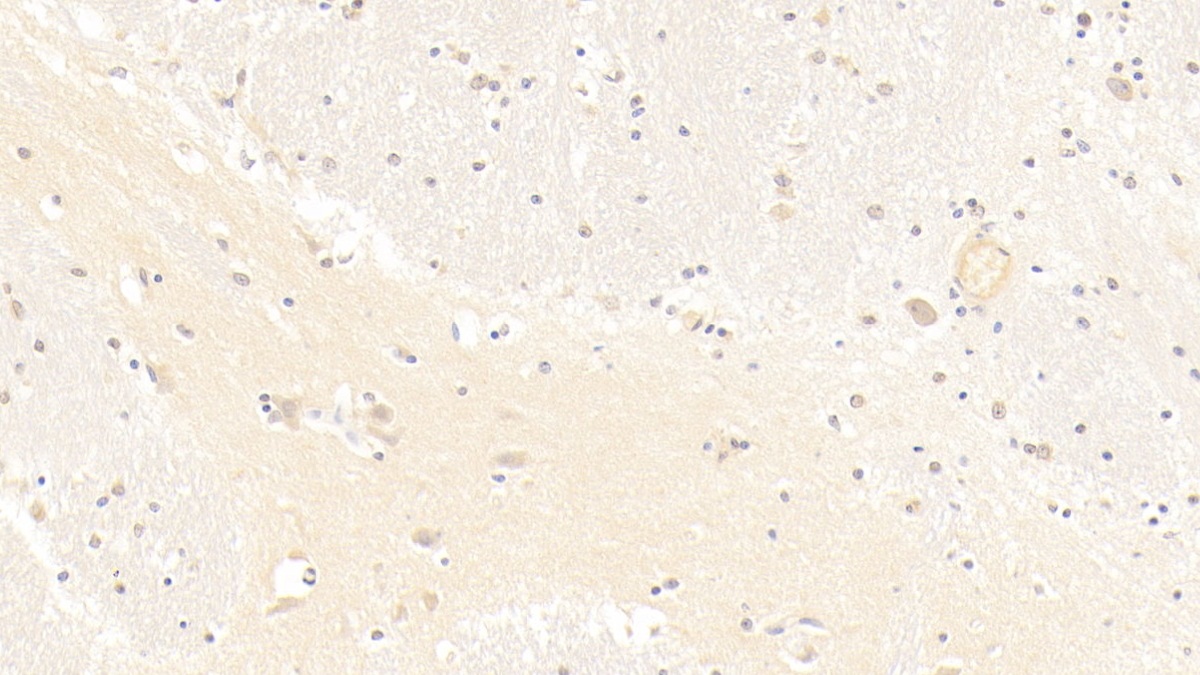 β-位淀粉样前体蛋白裂解酶1(bACE1)单克隆抗体